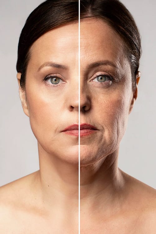 Skin tightening treatment (2)